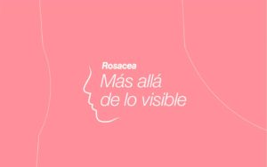 roseacea 1