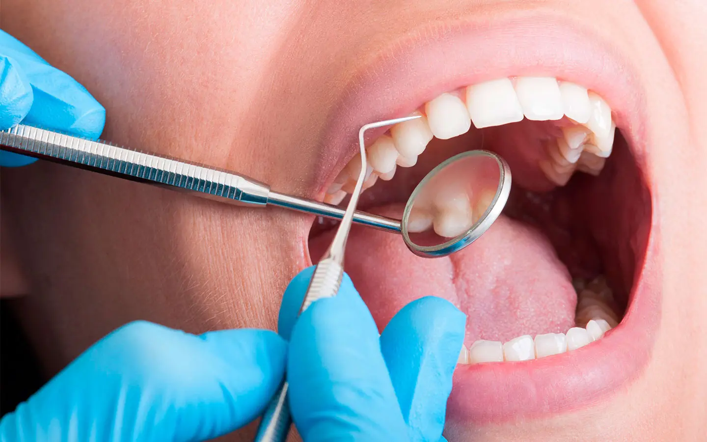Top 10 de los errores más comunes que están poniendo en riesgo tu salud bucal